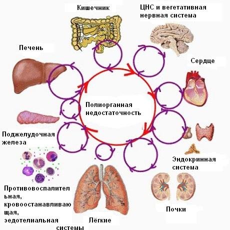 Полиорганная недостаточность Полиорганная недостаточность